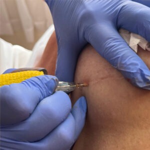 Paramedical Procedures